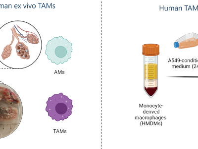 In vitro-Generierung von Tumor-assoziierten Makrophagen (TAMs) aus menschlichen Monozyten