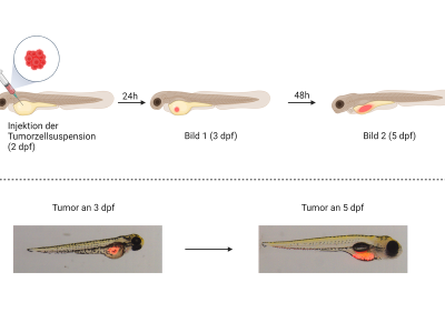 Untersuchung des Tumorwachstums in Zebrafischembryonen